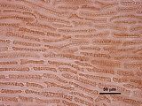 4 – Cellule corticali in visione superficiale